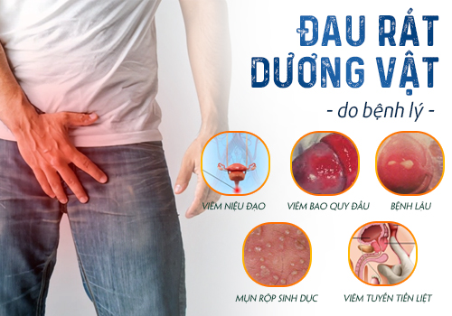 đau rát dương vật do bệnh lý