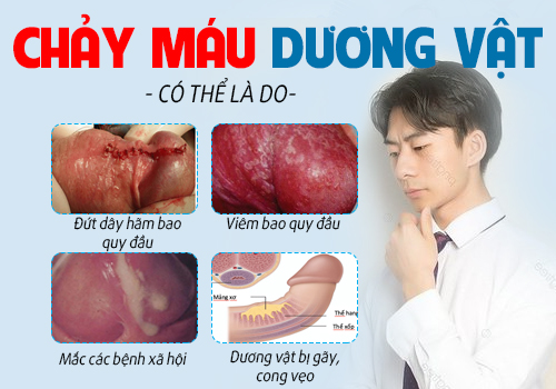 chảy máu dương vật nguyên nhân do đâu