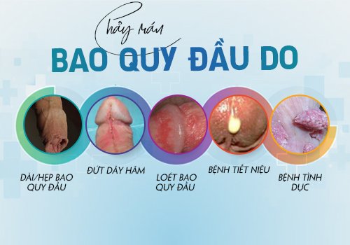 nguyên nhân gây bao quy đầu bị chảy máu