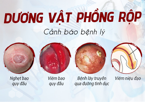 dương vật bị phồng rộp