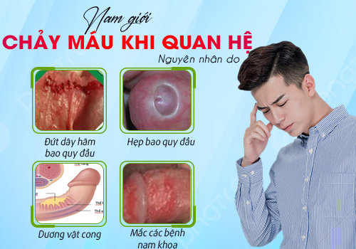 nguyên nhân nam giới chảy máu khi quan hệ