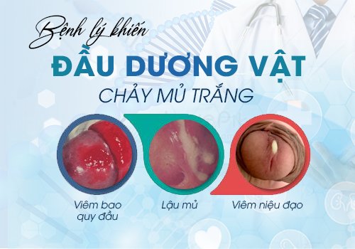 bệnh lý khiến đầu dương vật chảy mủ trắng